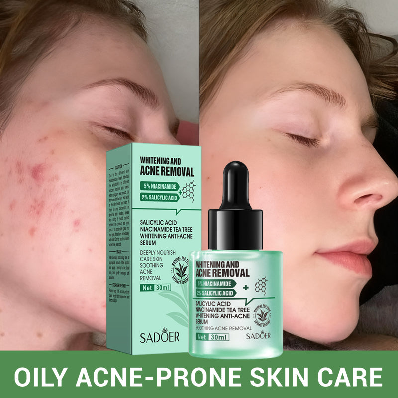 SADOER Salicylic Acid + Niacinamide Tea Tree Anti-Blemish Skincare 5-Piece Set
