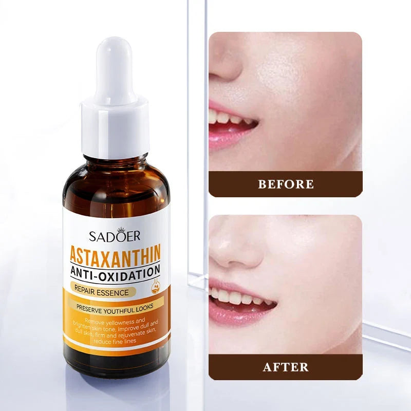SADOER Astaxanthin Anti-Oxidation Repair Essence – 30ml